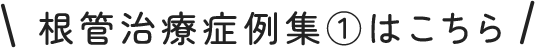 精密根管治療症例集①はこちら